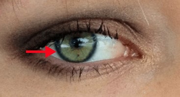 limbal ring visible in profile pic